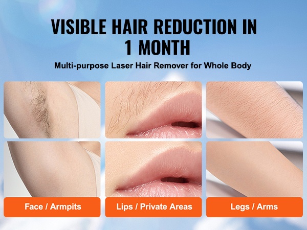 Ihonhoito kotona IPL-laitteella