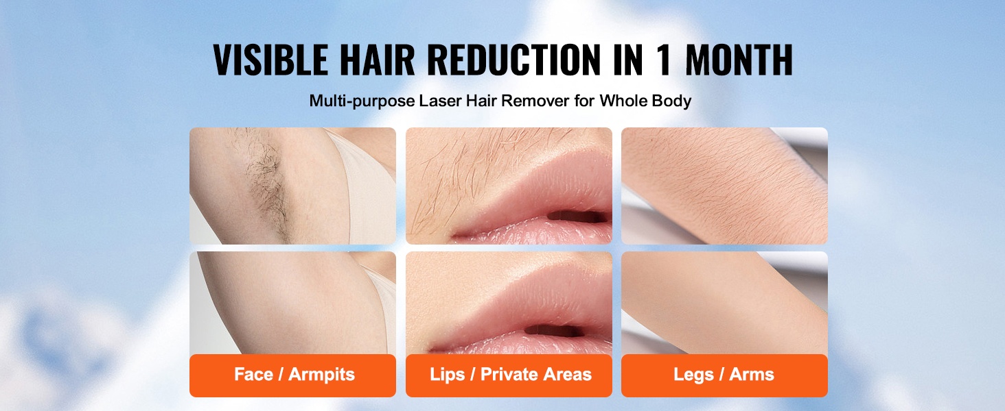 3-in-1 karvanpoisto, ihon nuorentaminen ja aknen hoito